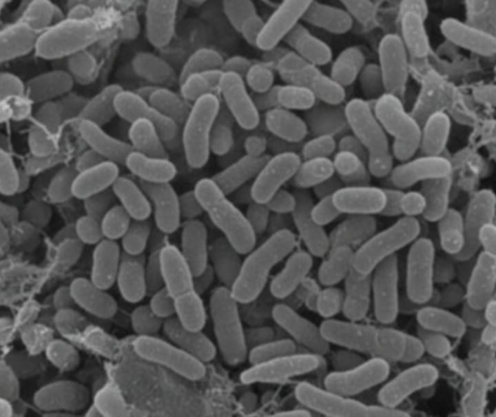 هل يؤثر الميكروبيوم المعوي على خطر الأمراض القلبية الأيضية بعد انقطاع الطمث؟